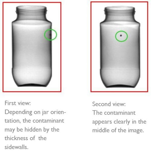 X-ray-vergleich showing the detection based on side view vs front middle view